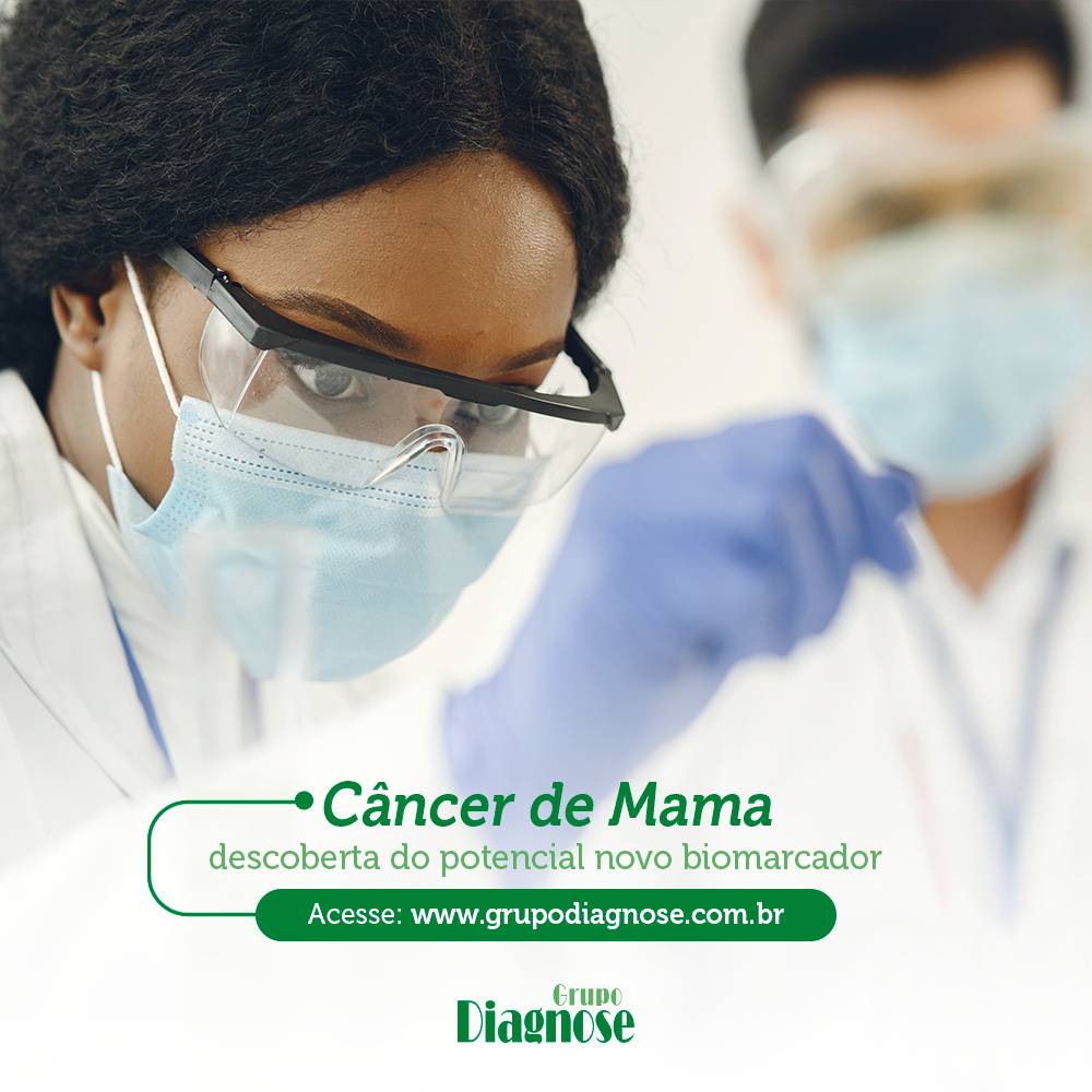 Câncer de Mama - Descoberta de potencial novo biomarcador